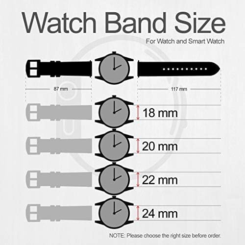 CA0246 Pembe Dudaklar Öper Fosil Hibrid Smartwatch için Deri Akıllı Watch Band Kayışı Nate, hibrid İK Latitude, hibrid Smartwatch