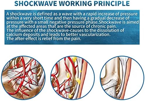 E-D Shockwave Terapi Makinesi Erektil Disfonksiyon için Vücut Kas Gevşeme Masaj Şok Dalga Makinesi Ağrı kesici vücut masajı ile