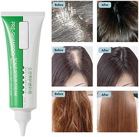 A / A Saç Derisi Ovma Şampuanı Tedavisi-Şampuan Öncesi Saç Derisi Ovma Macunu - 80g Kuru, Lapa Lapa, Kaşıntılı Saç Derisi Saç