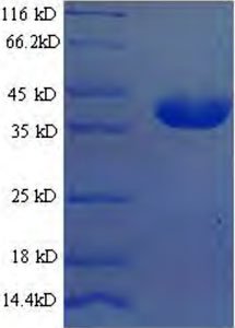 Rekombinant Escherichia coli Sitidilat kinaz (cmk) (Rekombinant Protein)
